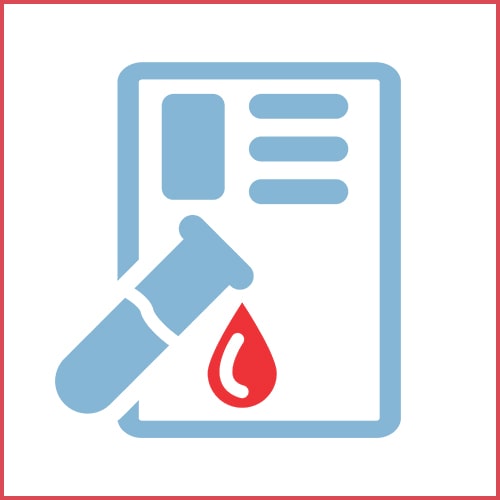 Blood-test-amp_-HIV-min.jpg