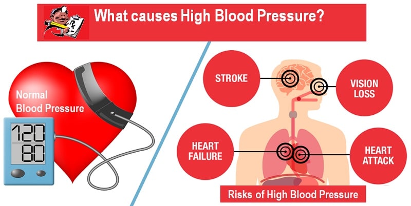 What causes High Blood Pressure?